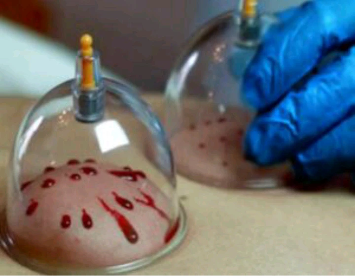 صورة لـ  معالجة بالطب البديل