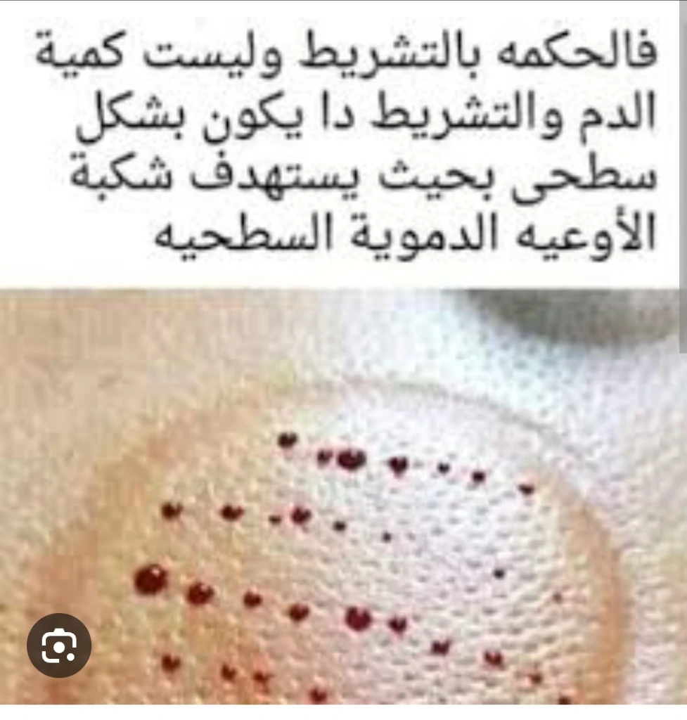 Additional image 4 of الحجامة الط…