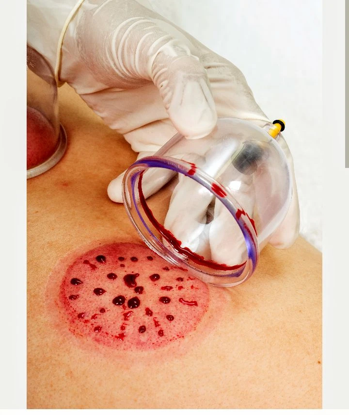 صورة لـ  الطب البديل