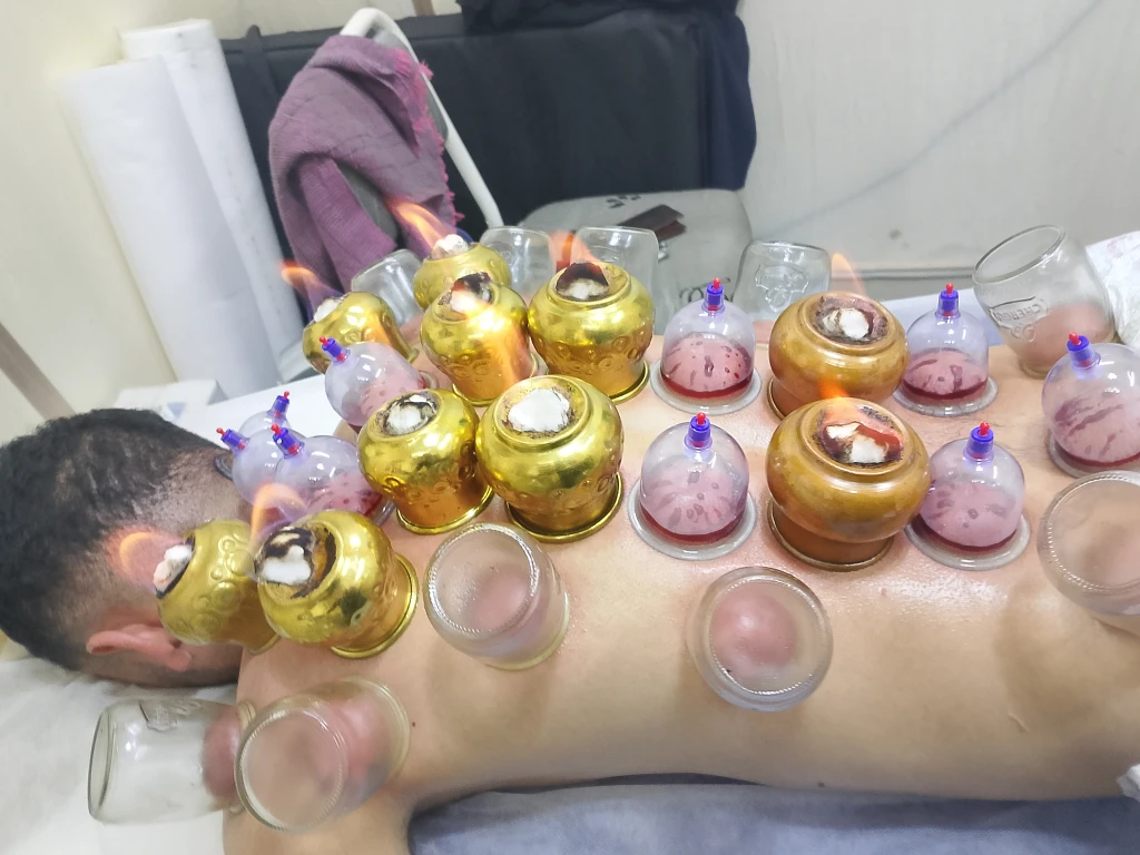 Additional image 3 of الحجامة بكل…