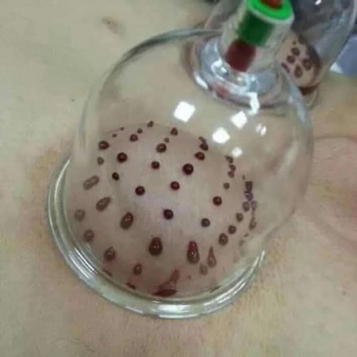 photo of Centre.al.M…